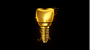 Implant Dentistry